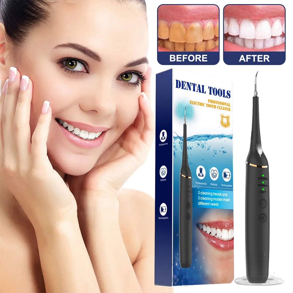 Electric Teeth Whitening