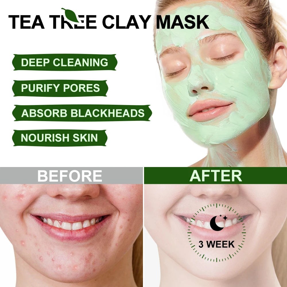 Acne Treatment Facial Mask Natural Tea Tree Pore Cleaning Blackhead Remove Oil Control Pimple Skin Care Products Face Clay Mask